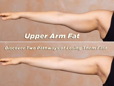 Upper-Arm-Fat
