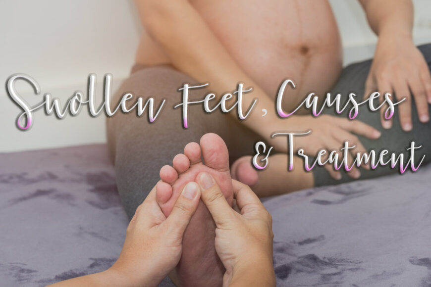Swollen Feet, Causes and Treatment