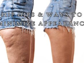 Hip Dips & Ways to Minimize Appearance