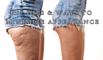Hip Dips & Ways to Minimize Appearance