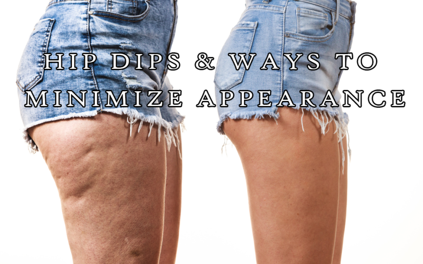Hip Dips & Ways to Minimize Appearance