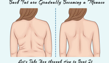 Back Fat are Gradually Becoming a Menace. Let’s Take You through How to Beat It