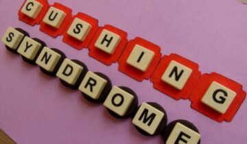 Cushing Syndrome – Everything to know and its Symptoms