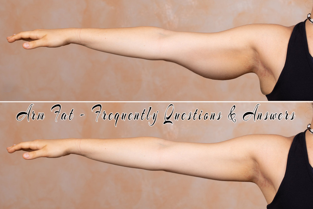 Arm Fat Frequently Questions Answers Damidols