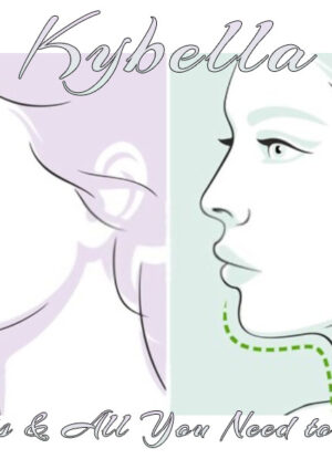 Kybella - Facts & All you need to know