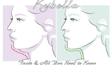 Kybella – Facts & All You Need to Know