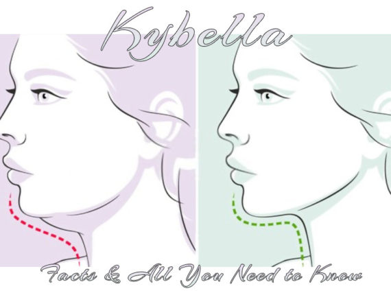 Kybella - Facts & All you need to know