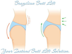Brazilian Butt Lift – Your Instant Butt Lift Solution.
