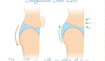 Brazilian Butt Lift – Your Instant Butt Lift Solution.