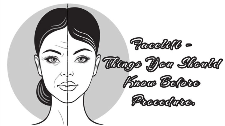 Facelift – Things You Should Know Before Procedure.
