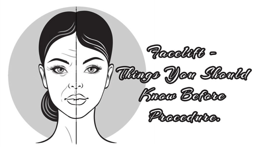 Facelift – Things You Should Know Before Procedure.