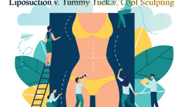 Liposuction v. Tummy Tuck v. Cool Sculpting