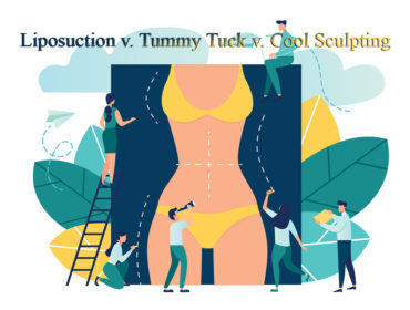 Liposuction-v,-Tummy-Tuch-