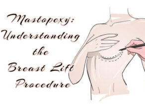 Mastopexy- Understanding the Breast Lift Procedure