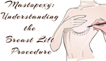 Mastopexy- Understanding the Breast Lift Procedure