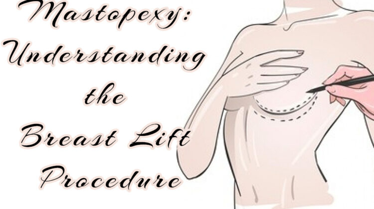 Mastopexy- Understanding the Breast Lift Procedure