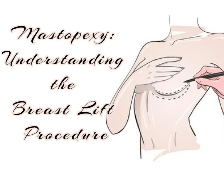 Mastopexy- Understanding the Breast Lift Procedure