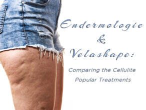 Endermologie v. Velashape: Comparing the Cellulite Popular Treatment