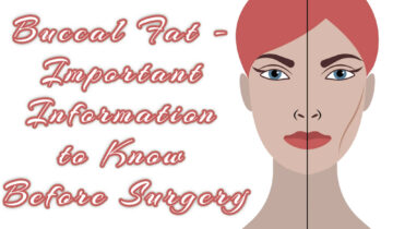 Buccal Fat – Important Information to Know Before Surgery