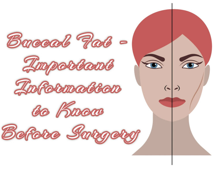 Buccal Fat – Important Information to Know Before Surgery