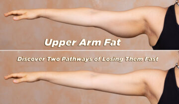 Upper Arm Fat – Discover Two Pathways of Losing Them Fast