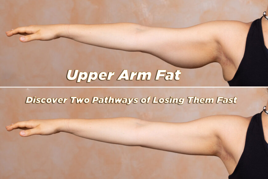 Upper Arm Fat – Discover Two Pathways of Losing Them Fast