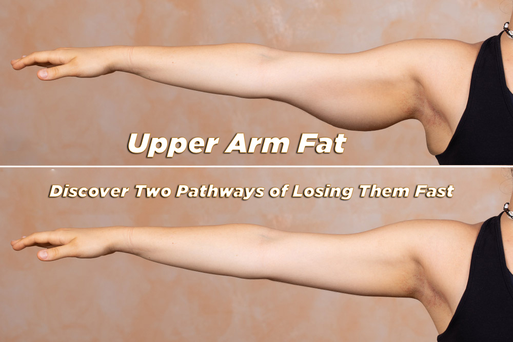 Upper-Arm-Fat
