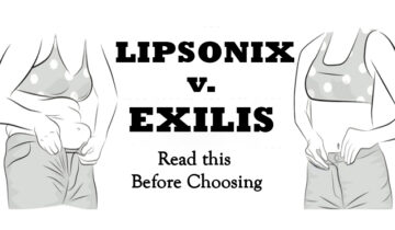 Liposonix v Exilis – Read This Before You Choose￼