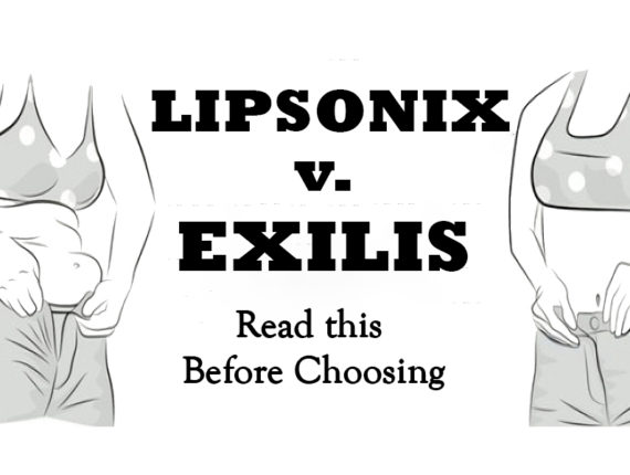 Liposonix v Exilis