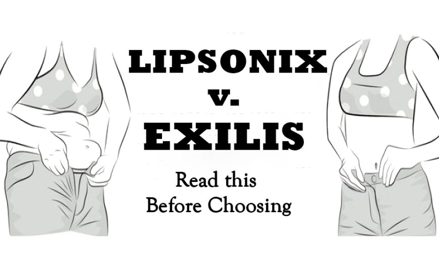 Liposonix v Exilis – Read This Before You Choose￼