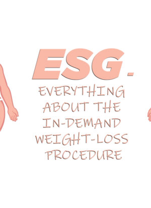 ESG-Endoscopic Sleeve Gastroplasty