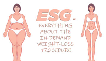 ESG – Everything About the In-demand Weight-Loss Procedure