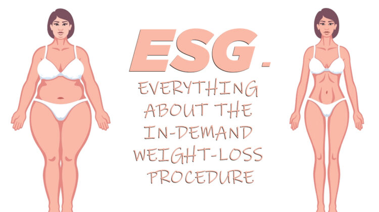 ESG – Everything About the In-demand Weight-Loss Procedure