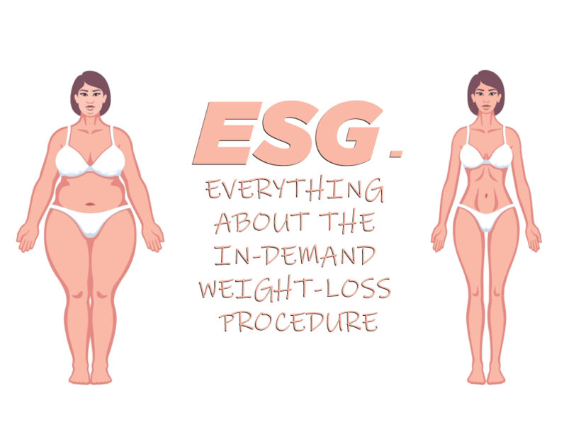 ESG – Everything About the In-demand Weight-Loss Procedure