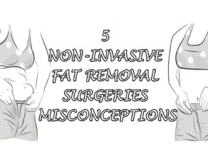 5 Non-Invasive Fat Removal Surgeries Misconceptions – Key Details to Note