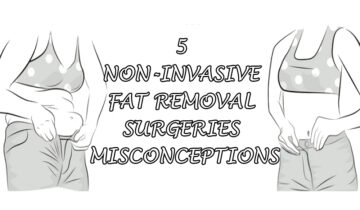 5 Non-Invasive Fat Removal Surgeries Misconceptions – Key Details to Note