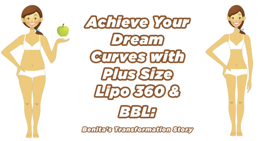 Achieve Your Dream Curves with Plus Size Lipo 360 & BBL: Benita’s Transformation Story